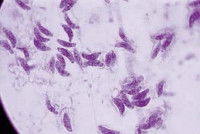 Vue microscopique du parasite de la toxoplasmose