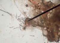 Un parasites du genre Demodex vus au microscope