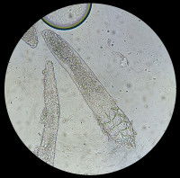 Vue au microscope de la démodécie