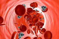 Représentation d'un diabète 