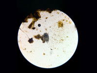 Une gale auriculaire vue au microscope