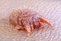 Vue au microscope de Sarcoptes scabiei