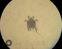 Un parasite qui provoque la gale