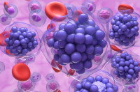 Des cellules de lymphome