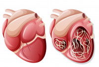 Schéma de l'emplacement des vers du coeur