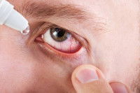 Un homme allergique se met des gouttes dans les yeux
